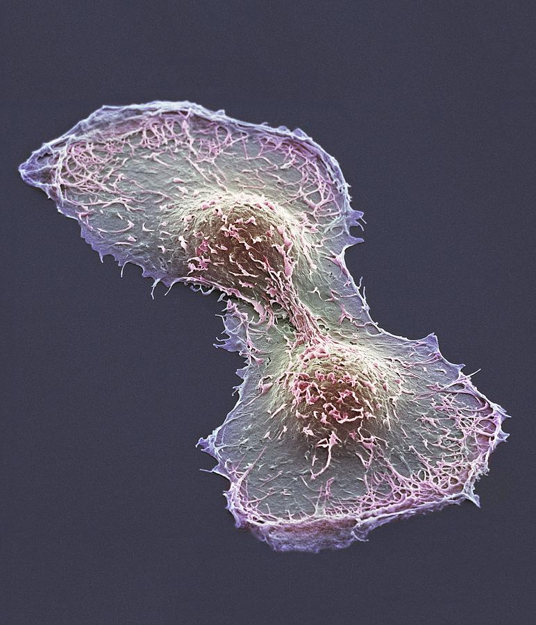 Hela Cell Division Sem Photograph By Thomas Deerinck Ncmir Pixels 