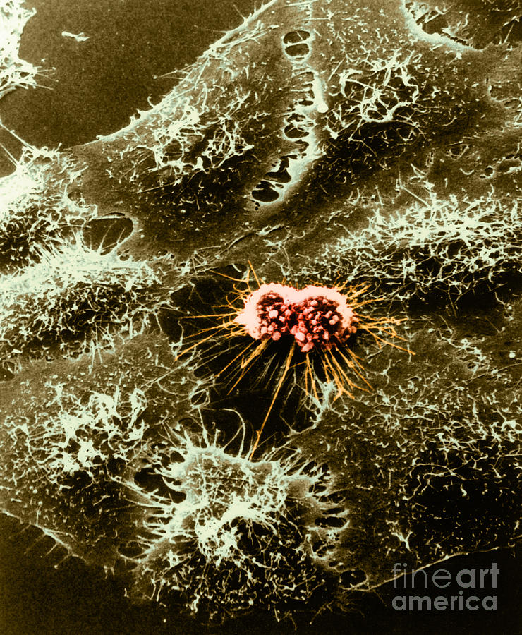 Hela Cells With Adenovirus #1 Photograph by Science Source