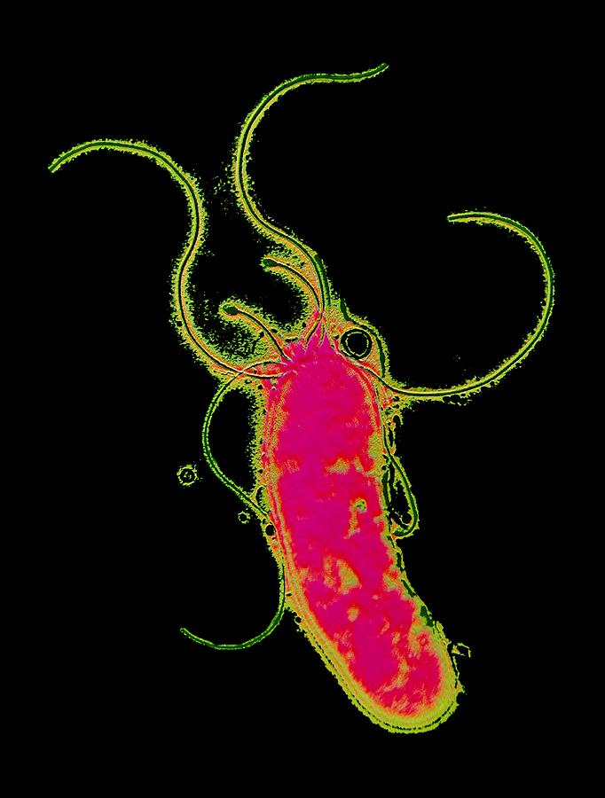 Helicobacter Pylori Photograph - Helicobacter Pylori Bacterium #1 by P. Hawtin, University Of Southampton