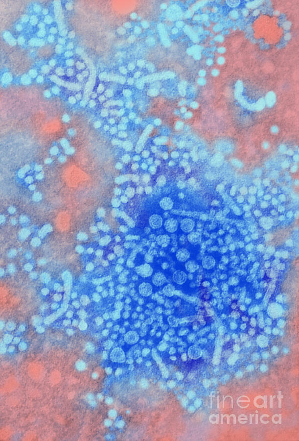 Hepatitis B Tem #1 Photograph by Science Source