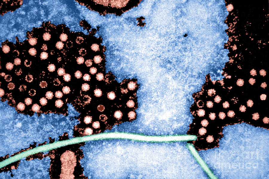 Science Photograph - Hepatitis-e Virus, Em #1 by Science Source