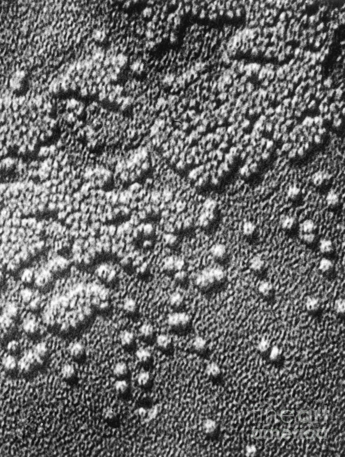 Hepatitis Virus #1 Photograph by Omikron