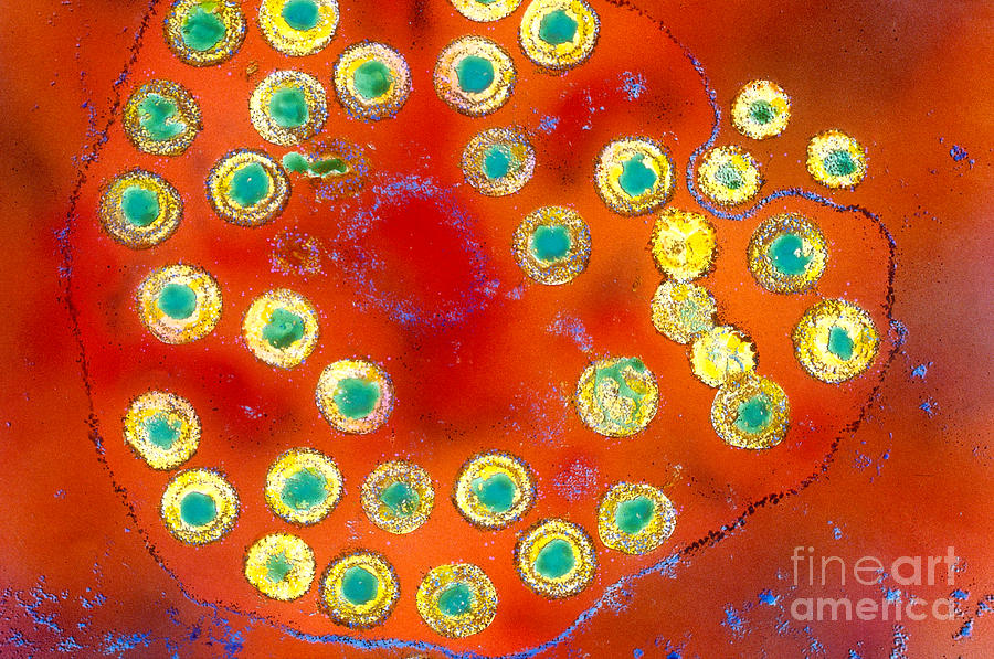 Science Photograph - Herpes Simplex #1 by Science Source