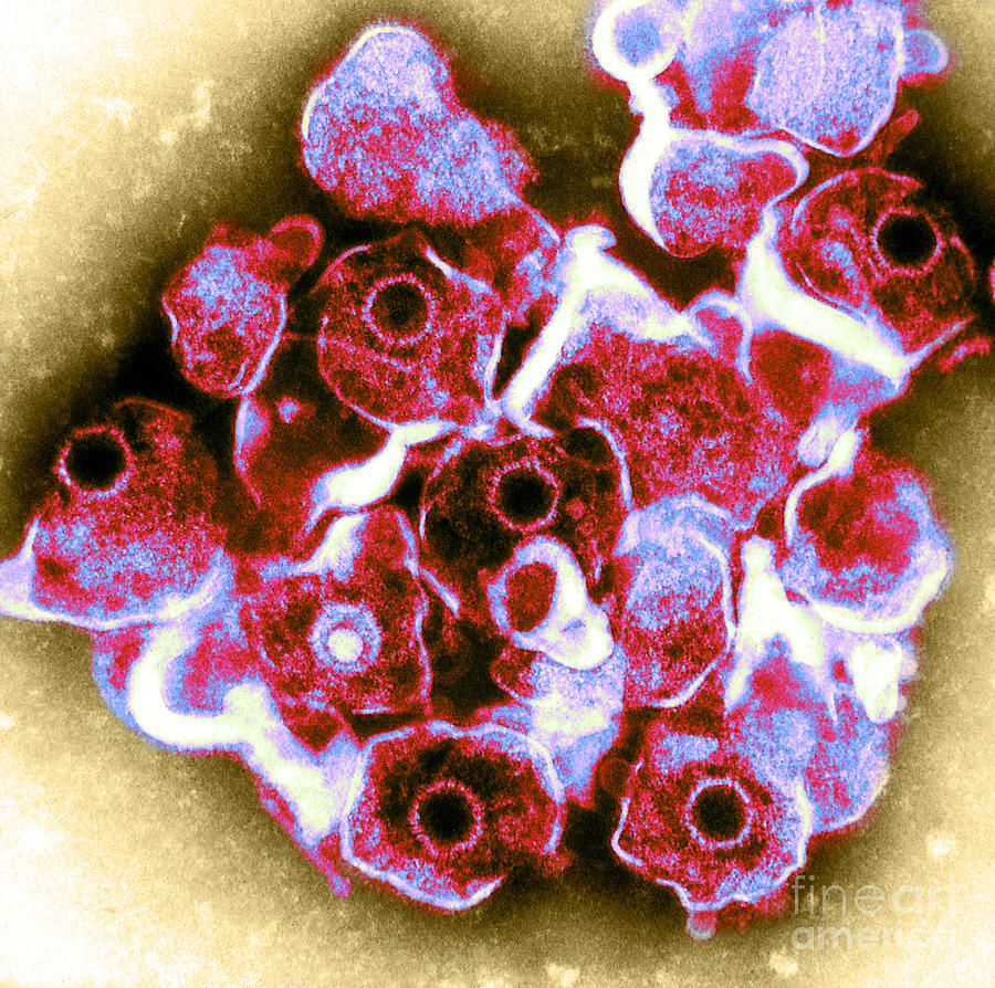Herpes Simplex Virus Tem #1 Photograph by ASM/Science Source