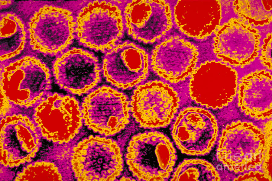 Pathology Photograph - Herpes Virus #1 by Science Source