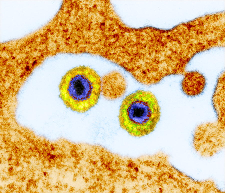 Гемохроматоз картинки мультяшные. Herpes virus 6