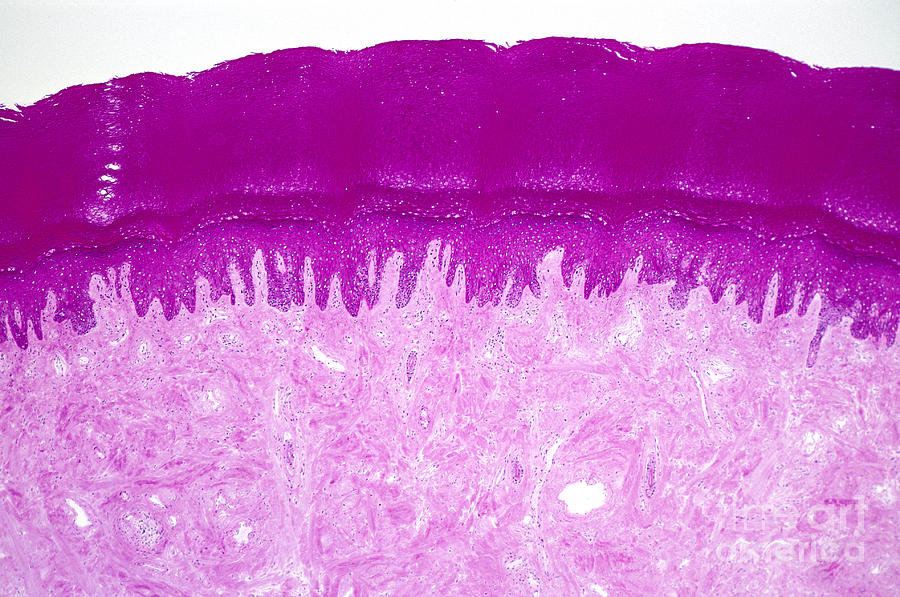 Histology Of Skin Of Palm Photograph by M. I. Walker