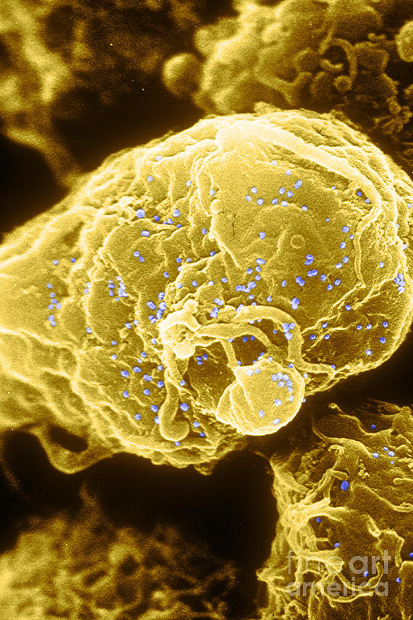 Hiv-1 Infected T4 Lymphocyte Sem #1 Photograph by Science Source