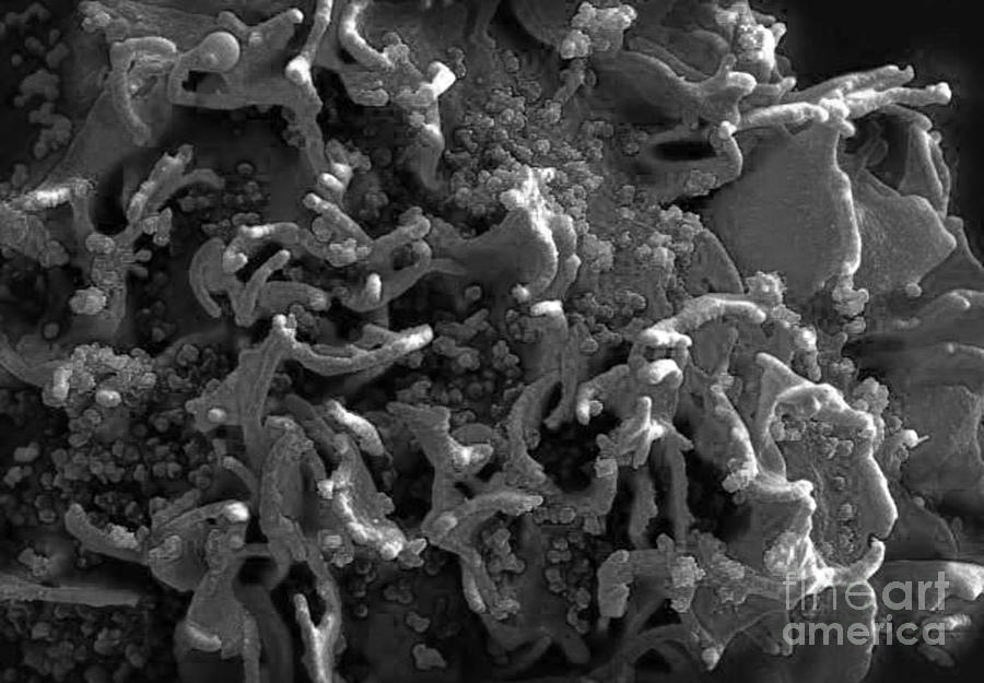 Hiv-infected H9 T Cell, Sem #1 Photograph by Science Source