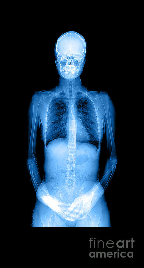 Human Body X-ray And Ct #1 Photograph by Medical Body Scans
