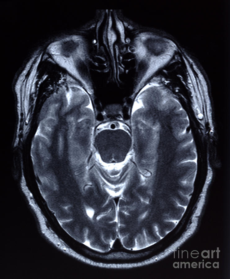 Skull Photograph - Human Brain #1 by Ted Kinsman