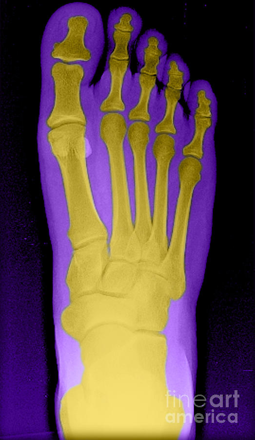 Human Foot #1 Photograph by Medical Body Scans