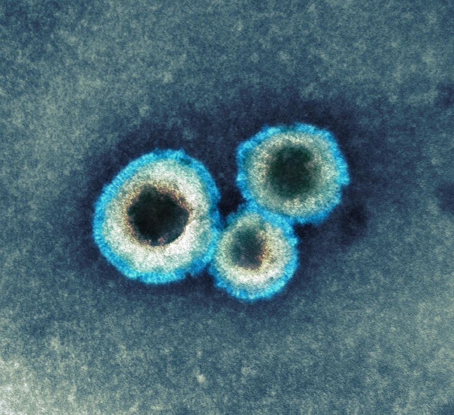 Human Metapneumovirus Particles, Tem Photograph by Brian Megson, Centre