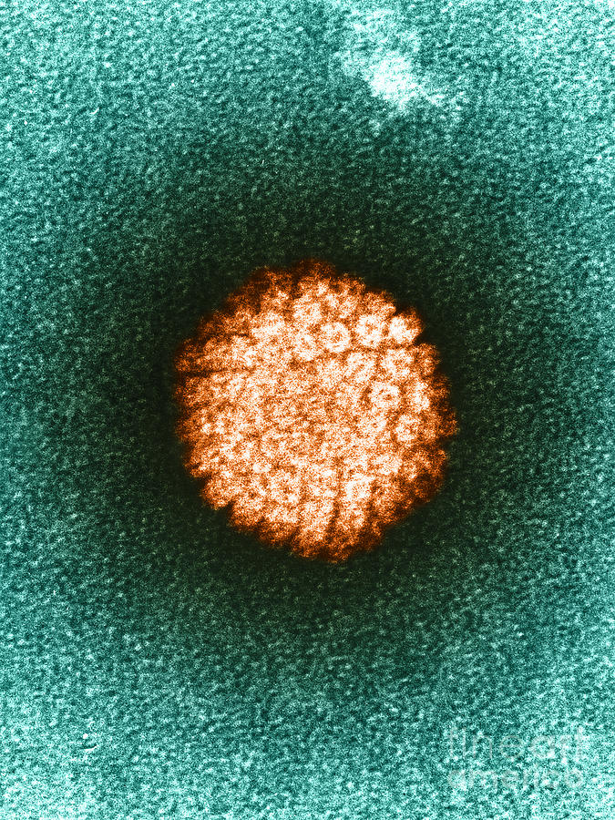 Human Papilloma Virus Hpv #1 Photograph by Science Source