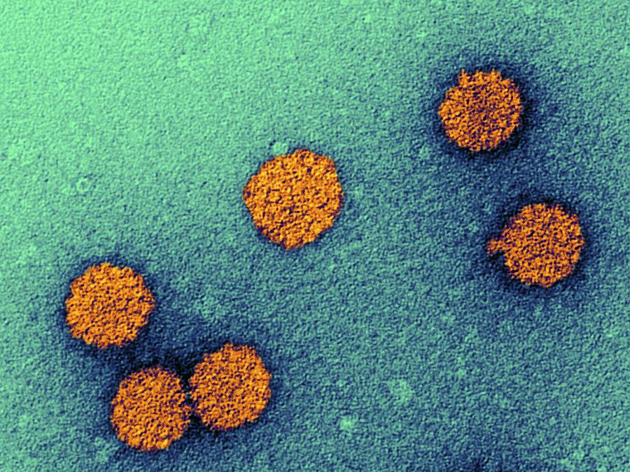 Human Papillomavirus Particles, Tem Photograph by Dr Klaus Boller - Pixels