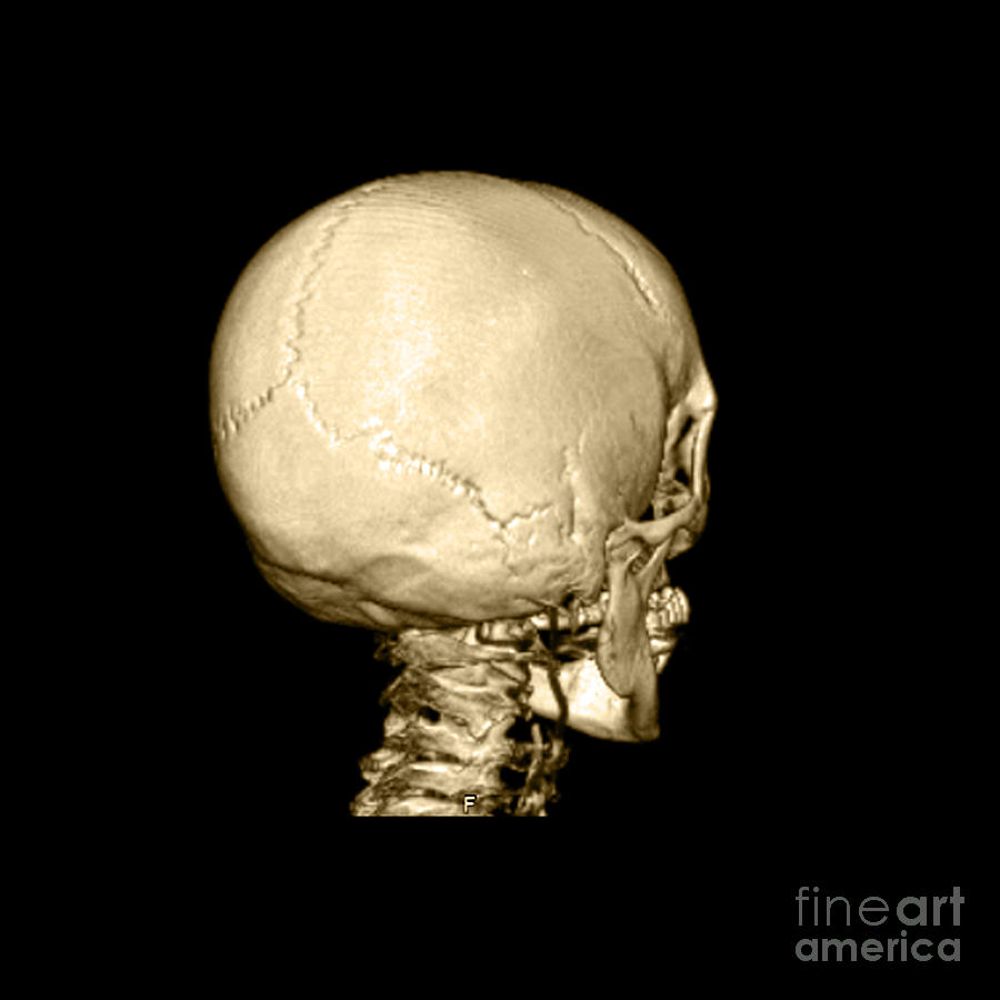Skull Photograph - Human Skull #1 by Medical Body Scans