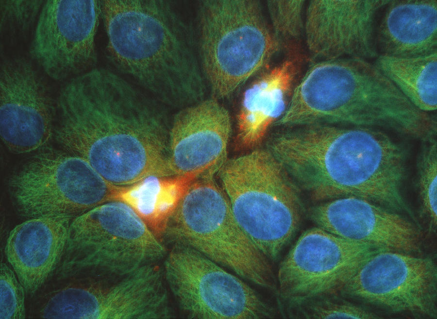 Images Photograph - Immunofluorescent Lm Of Squamous Carcinoma Cells #1 by Nancy Kedersha