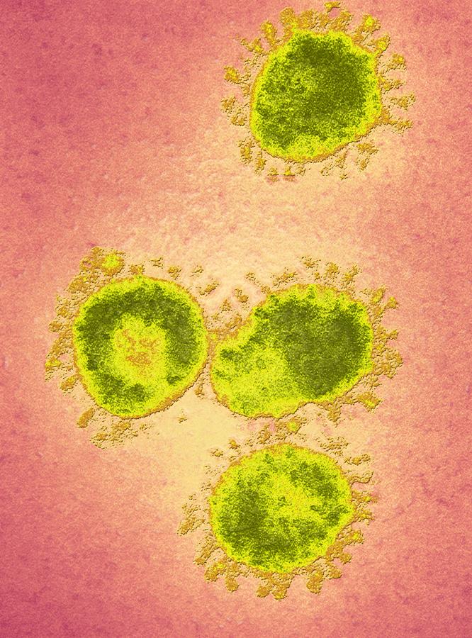 Infectious Bronchitis Virus (ibv), Tem Photograph by Ami Images - Pixels