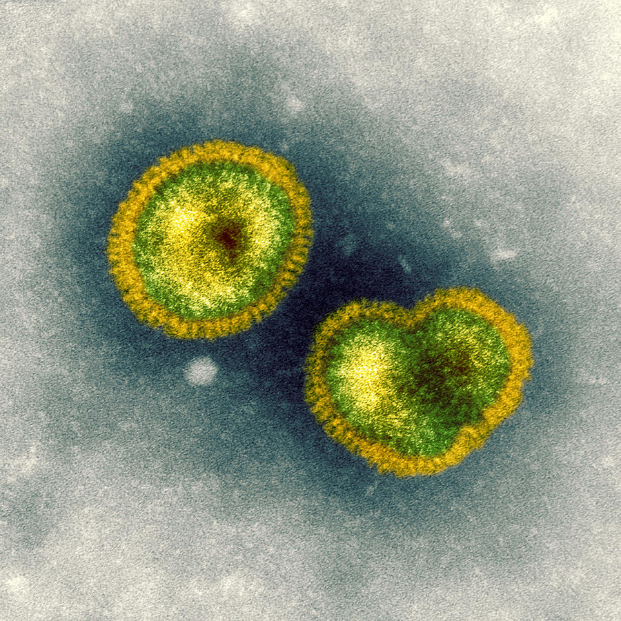 Influenzavirus B, Tem Photograph by Hazel Appleton, Centre For ...