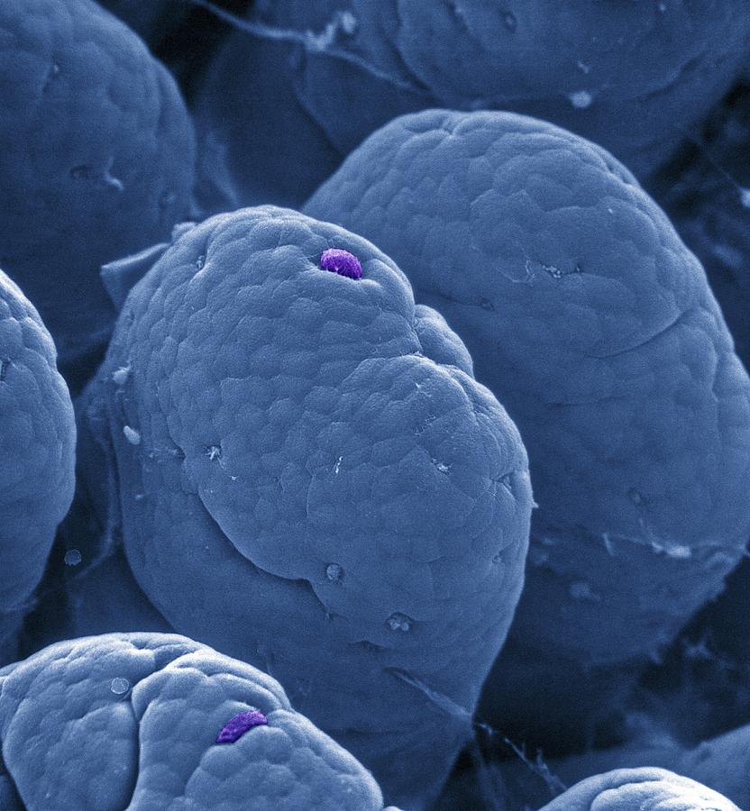 Intestinal Villus Photograph - Intestinal Villi Cell Loss, Sem #1 by 