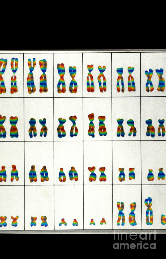 Karyotype Of Male Chromosomes #1 Photograph by Omikron