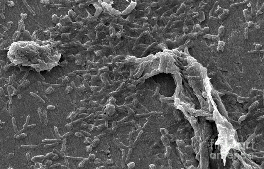 Science Photograph - Legionella Pneumophila, Sem #1 by Science Source