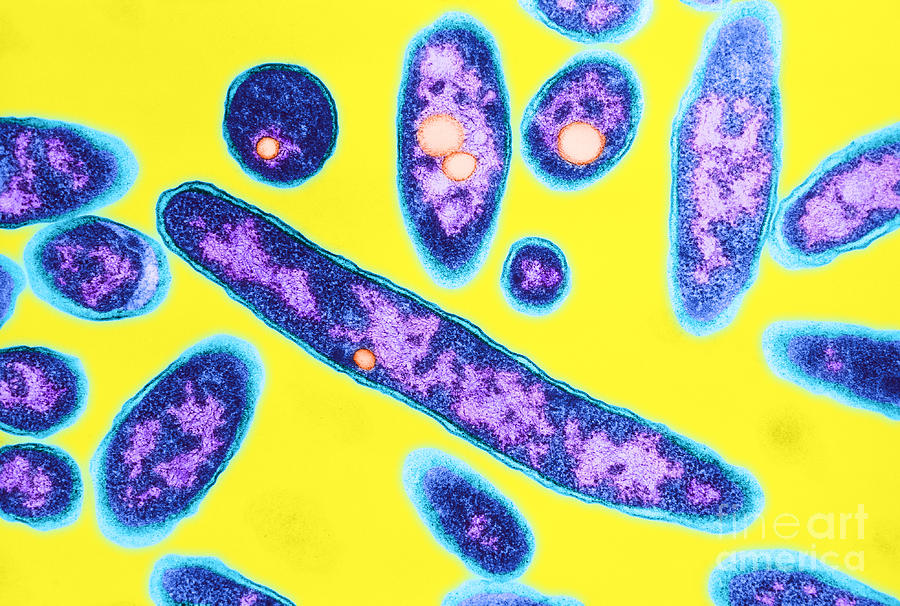 Legionnaires Disease Bacteria #1 Photograph by Science Source