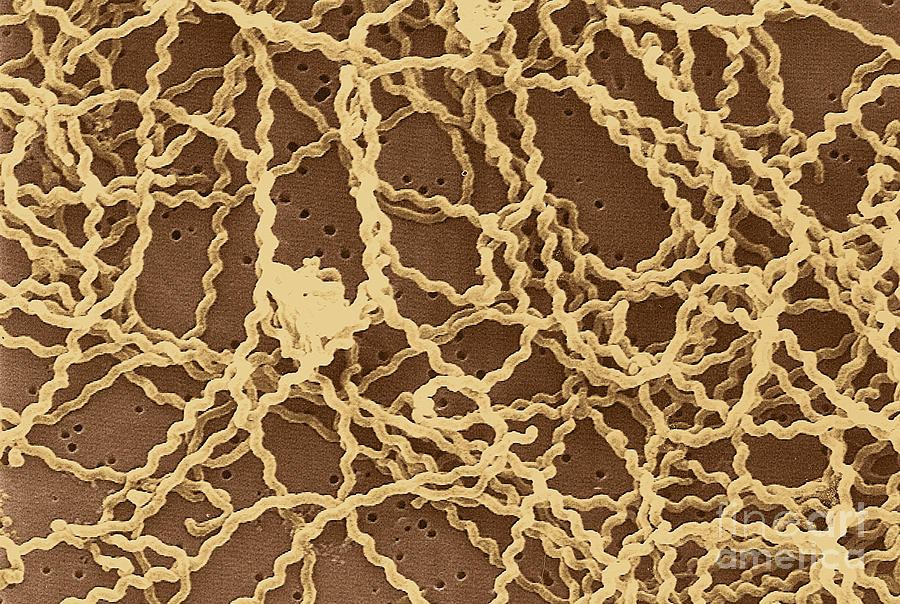 Leptospira #1 Photograph by Science Source