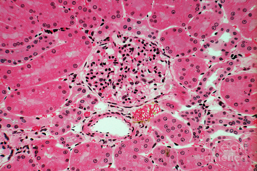 Lm Of Kidney Glomeruli #1 Photograph by M. I. Walker