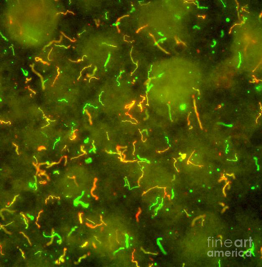 Microbiology Photograph - Lyme Disease, Borrelia Burgdorferi #1 by Science Source