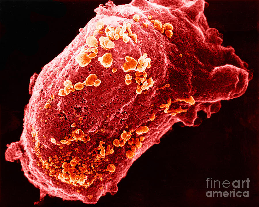 Sem Photograph - Lymphocyte With Hiv Cluster #1 by Science Source