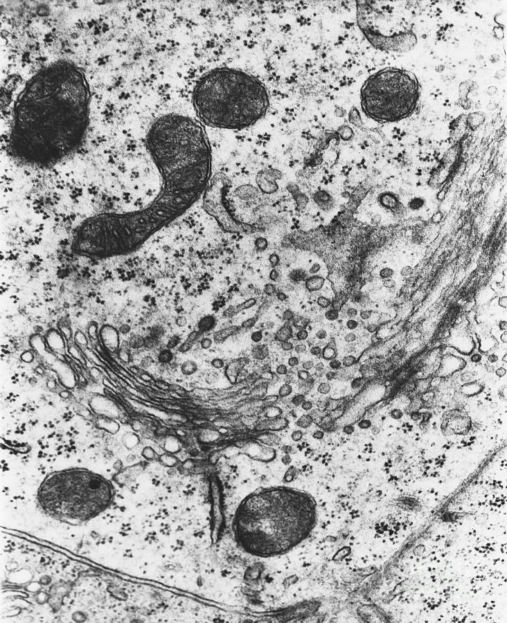 Lysosomes, Tem #1 Photograph by Science Source