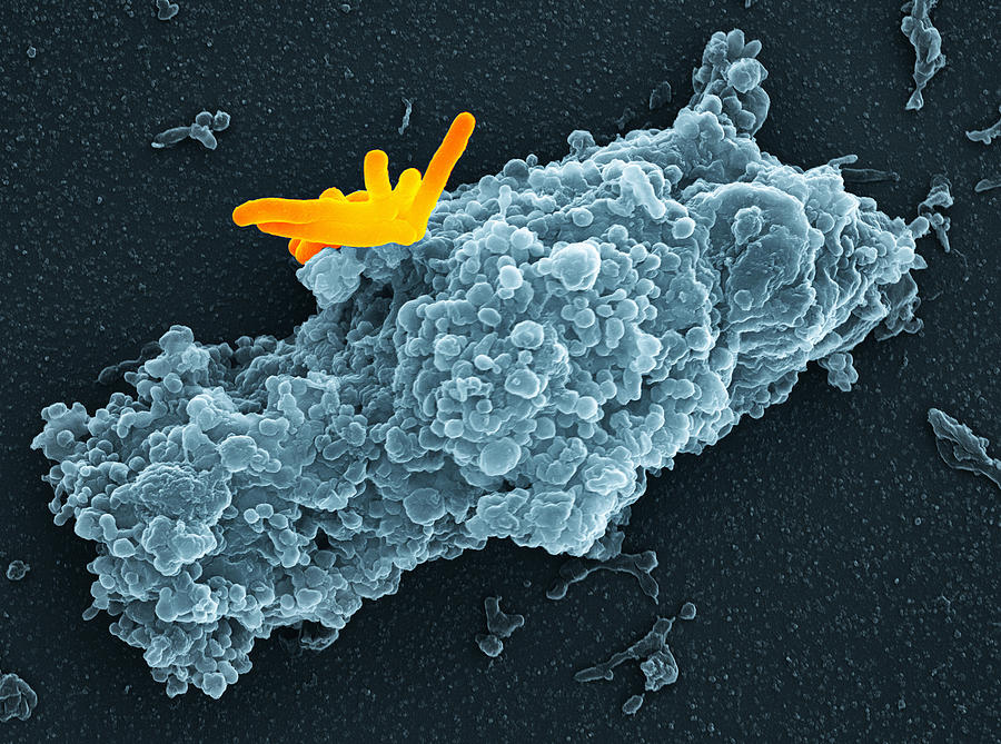 Mycobacterium Tuberculosis Photograph - Macrophage Engulfing Bacteria, Sem #1 by 