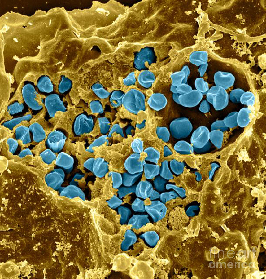 Macrophage Infected With Francisella #1 Photograph by Science Source
