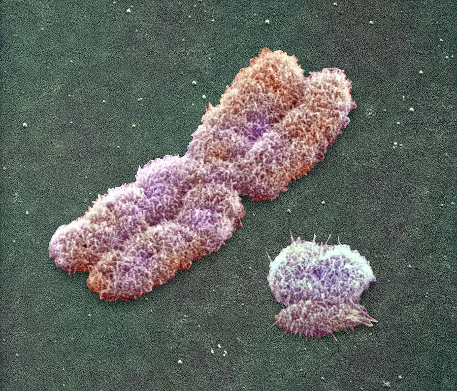 Male Sex Chromosomes Sem Photograph By Power And Syred Fine Art America