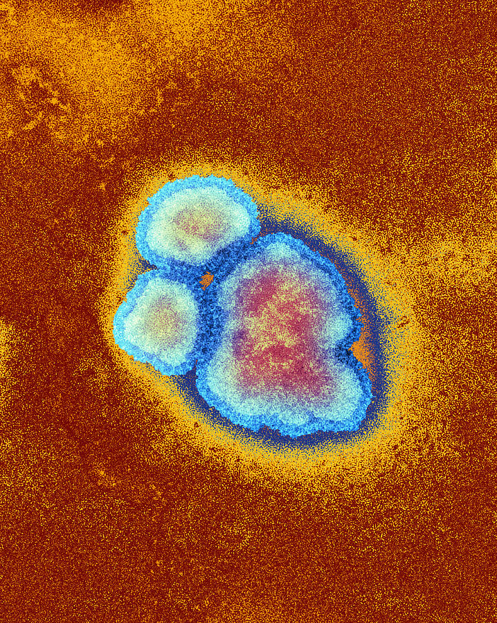 Pathogen Photograph - Measles Virus Particles, Tem #1 by Hazel Appleton, Centre For Infectionshealth Protection Agency
