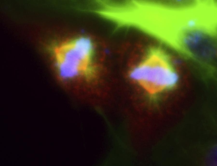 Mitosis, Fluorescence Micrograph Photograph by Robert Mcneil, Baylor ... Biology Diagrams