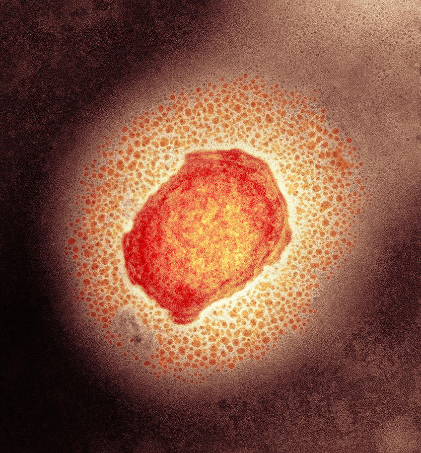 1-monkeypox-virus-particle-tem-hazel-appleton-centre-for-infectionshealth-protection-agency.jpg (836×900)