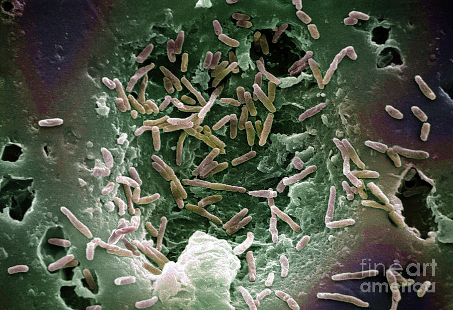Mycobacterium Chelonae Photograph by Science Source