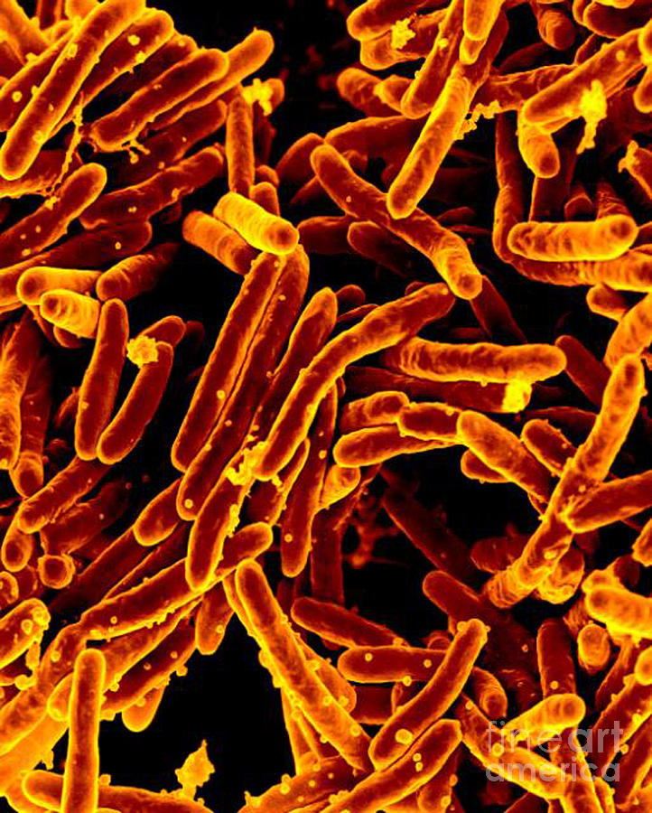 Mycobacterium Tuberculosis Bacteria, Sem #1 Photograph by Science Source