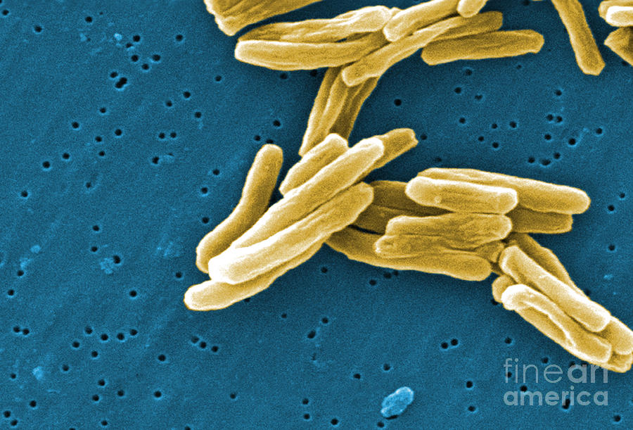 Mycobacterium Tuberculosis Sem #2 Photograph by Science Source