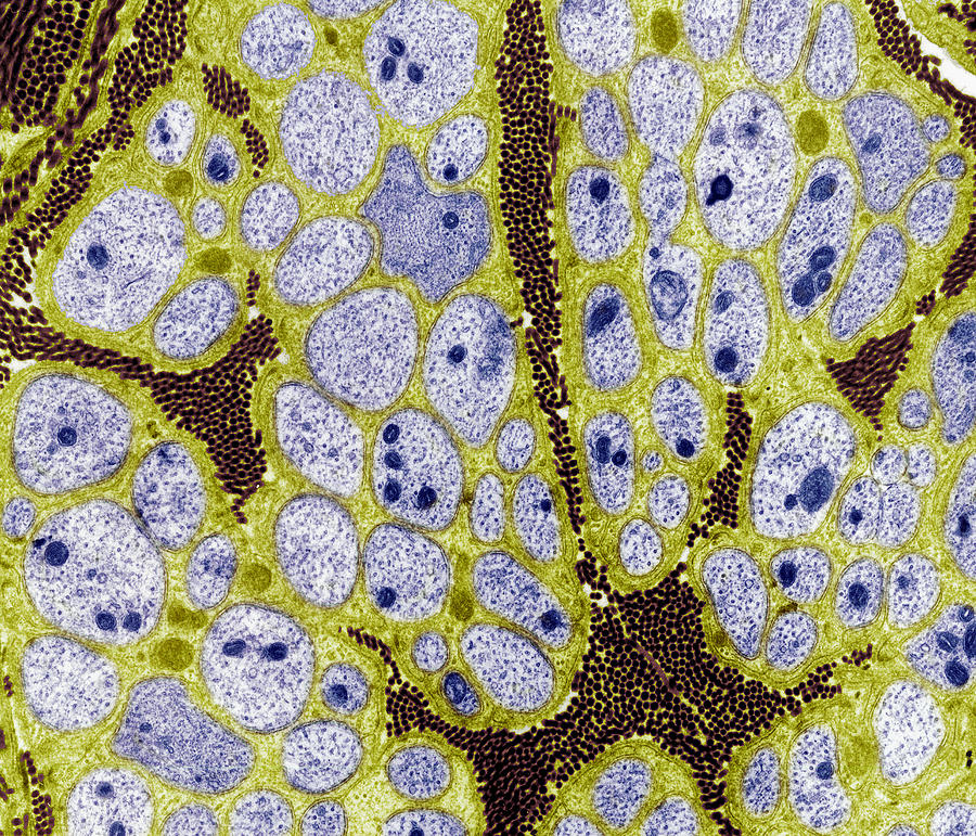 Schwann Cell Photograph - Nerve Fibres, Tem #1 by Steve Gschmeissner