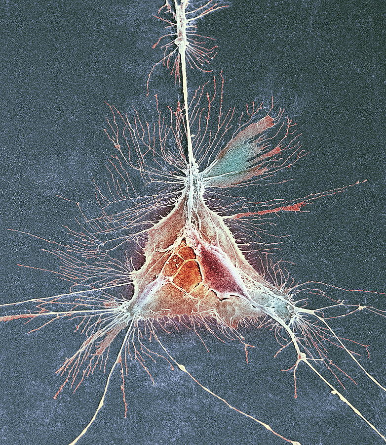 Нервная система фото под микроскопом