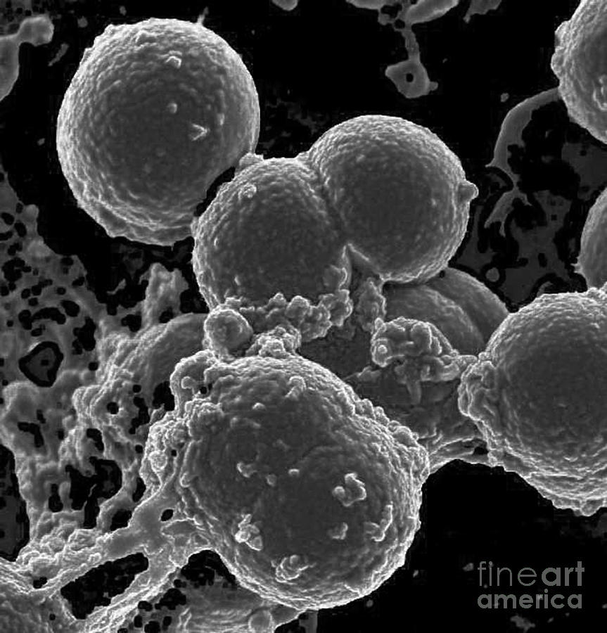 Neutrophil Ingesting Mrsa Bacteria, Sem #1 Photograph by Science Source