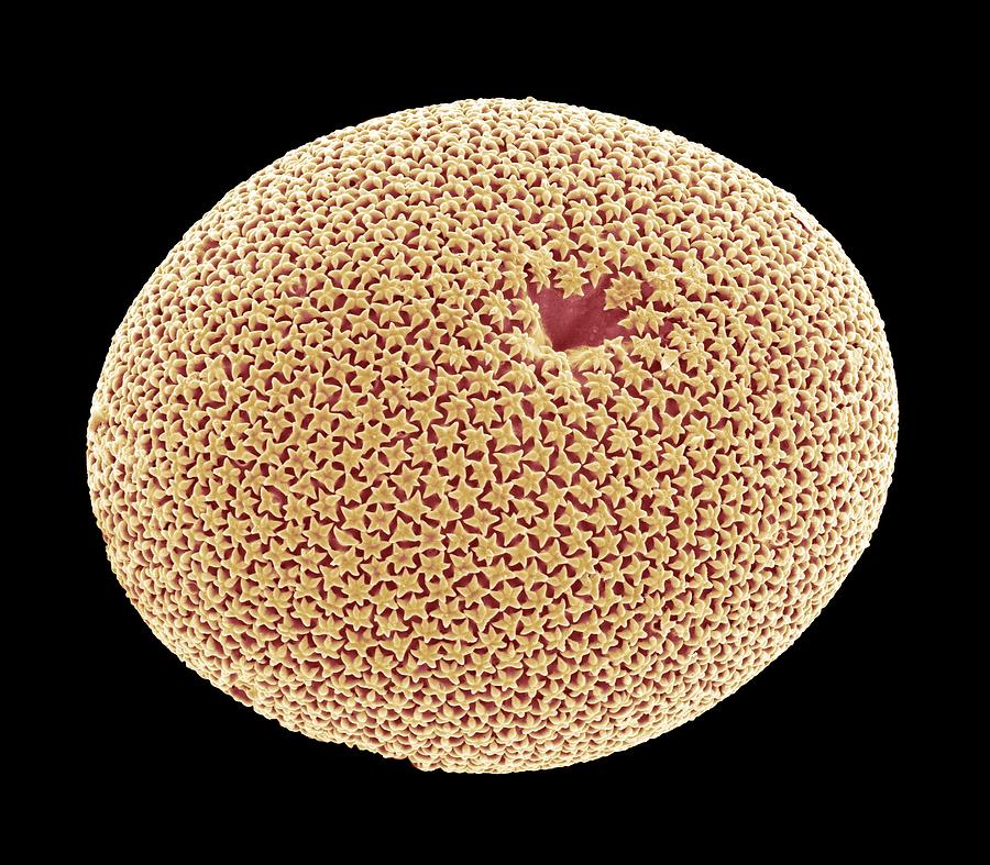 Wildlife Photograph - Orbulina Foraminiferan, Sem #1 by Steve Gschmeissner