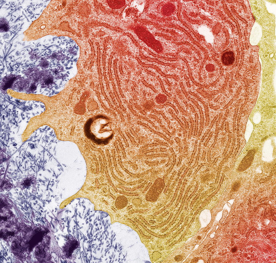 Osteoclast, Tem #1 by Steve Gschmeissner