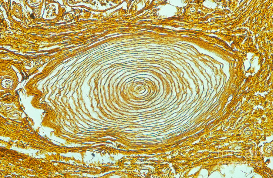 Pacinian Corpuscle, Lm #1 Photograph by M. I. Walker