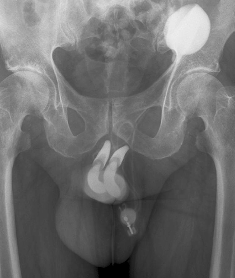 snapshot x- ray penis