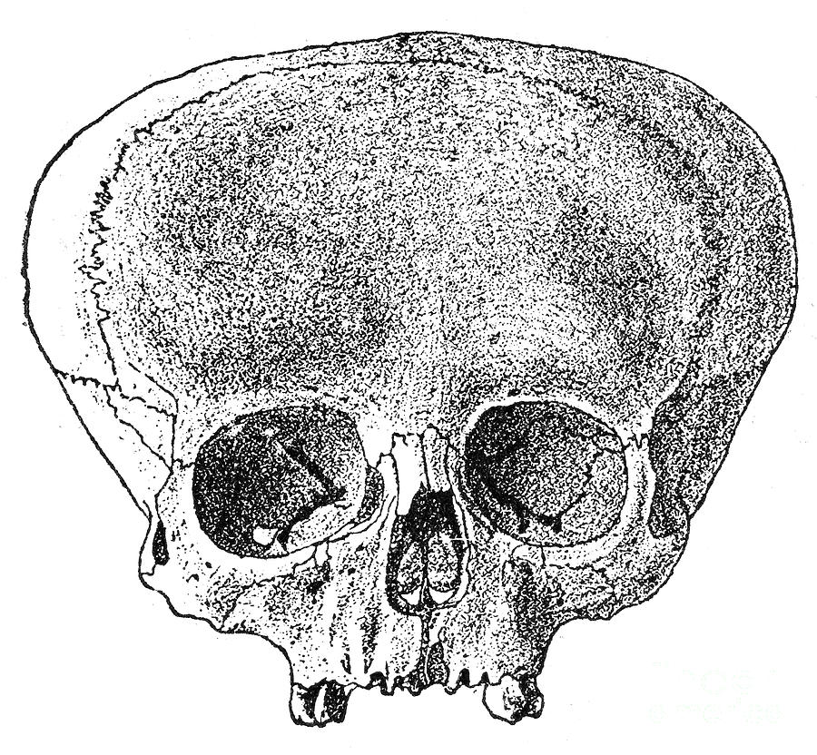 Ancient Photograph - Peru: Aymara Skull by Granger