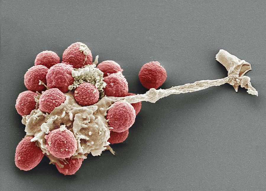Aspergillus Fumigatus Photograph - Phagocytosis Of Fungal Spores, Sem #1 by Prof Matthias Gunzer